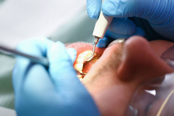 Best Emergency Broken Tooth Repair in Drain, OR