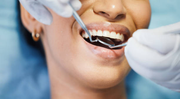 Best Emergency Tooth Extraction in Drain, OR